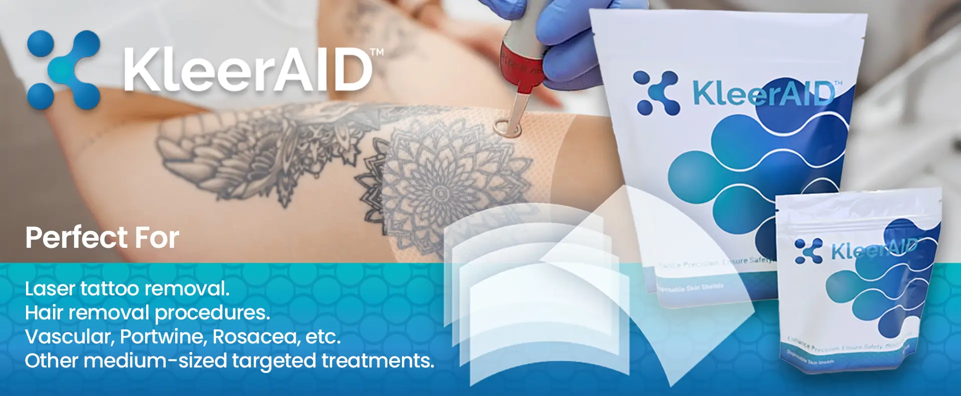 Header-tattoo-removal kleeraid masks 2